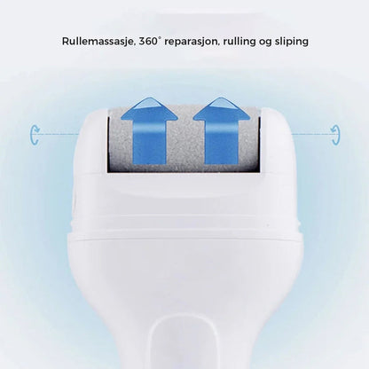 Electric foot callus remover - rechargeable and gentle