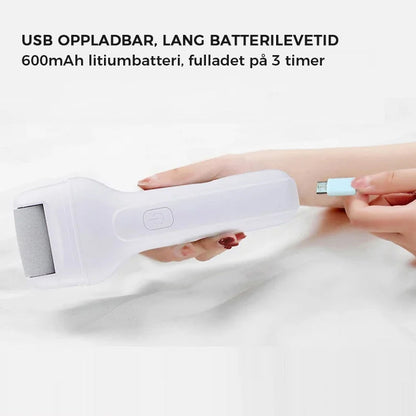 Electric foot callus remover - rechargeable and gentle