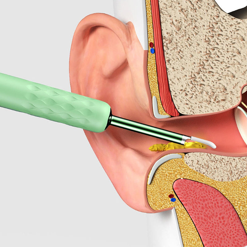 Ear cleaner with camera endoscope for safe earwax cleaning