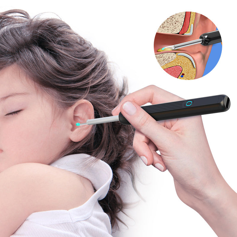 Ear wax remover with HD camera and app